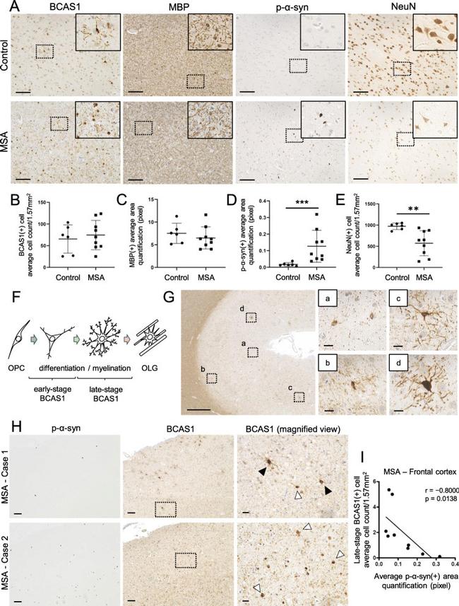 MBP Antibody in Immunohistochemistry (IHC)