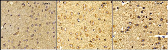 SIRT1 Antibody in Immunohistochemistry (IHC)