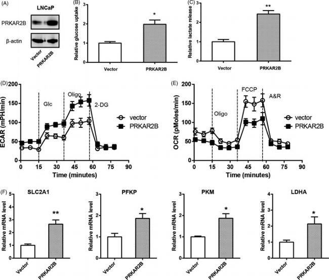 PRKAR2B Antibody in Western Blot (WB)