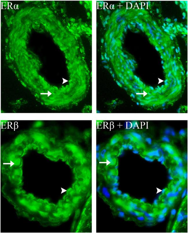 Estrogen Receptor beta Antibody in Immunohistochemistry (IHC)