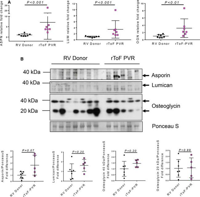 Asporin Antibody in Western Blot (WB)