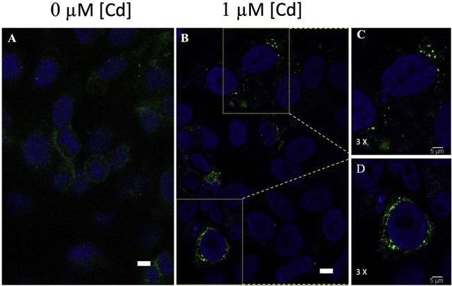 CTR1 Antibody in Immunocytochemistry (ICC/IF)