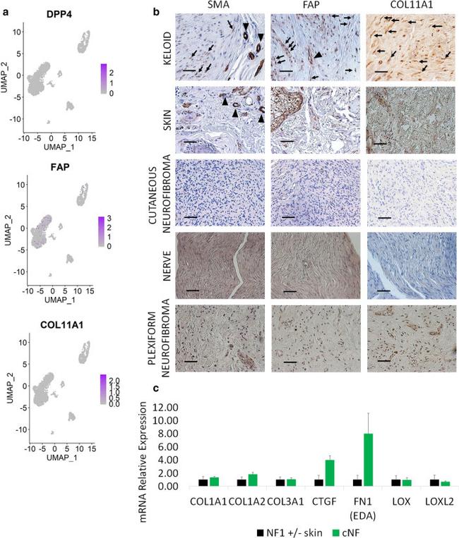 COL11A1 Antibody in Immunohistochemistry (IHC)