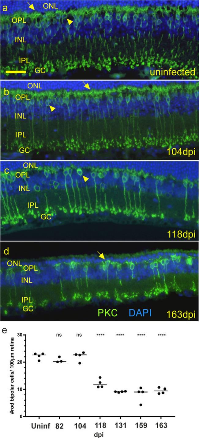 PKC alpha Antibody in Immunohistochemistry (IHC)