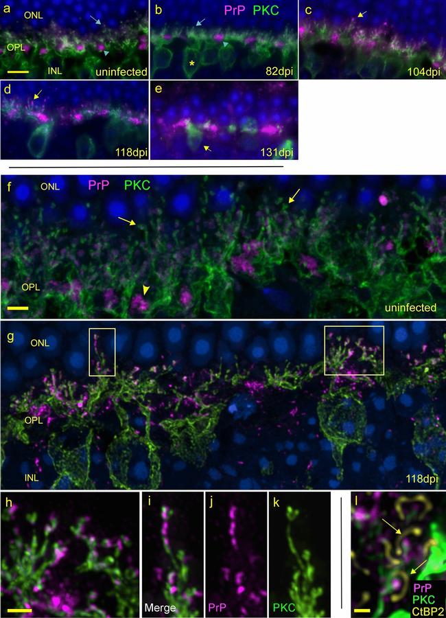 PKC alpha Antibody in Immunocytochemistry (ICC/IF)