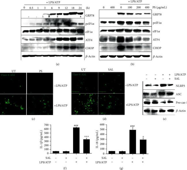 ATF4 Antibody in Western Blot (WB)