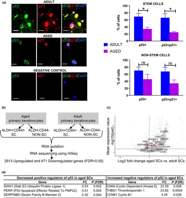 p21 Antibody in Immunocytochemistry (ICC/IF)