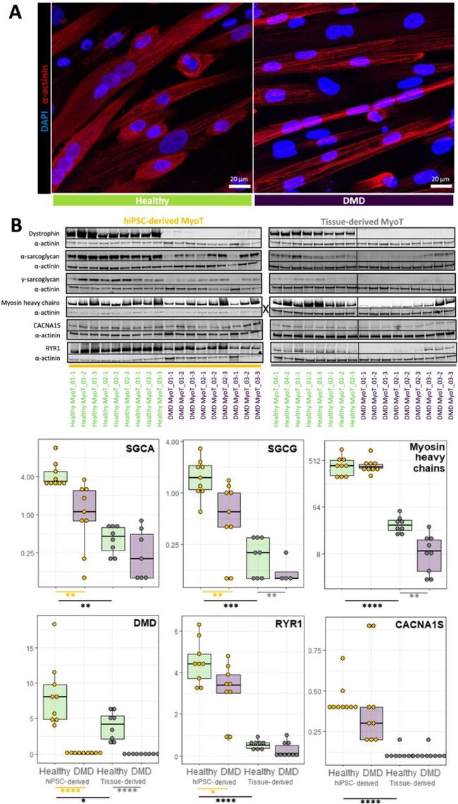 CaV1.1 Antibody in Western Blot (WB)