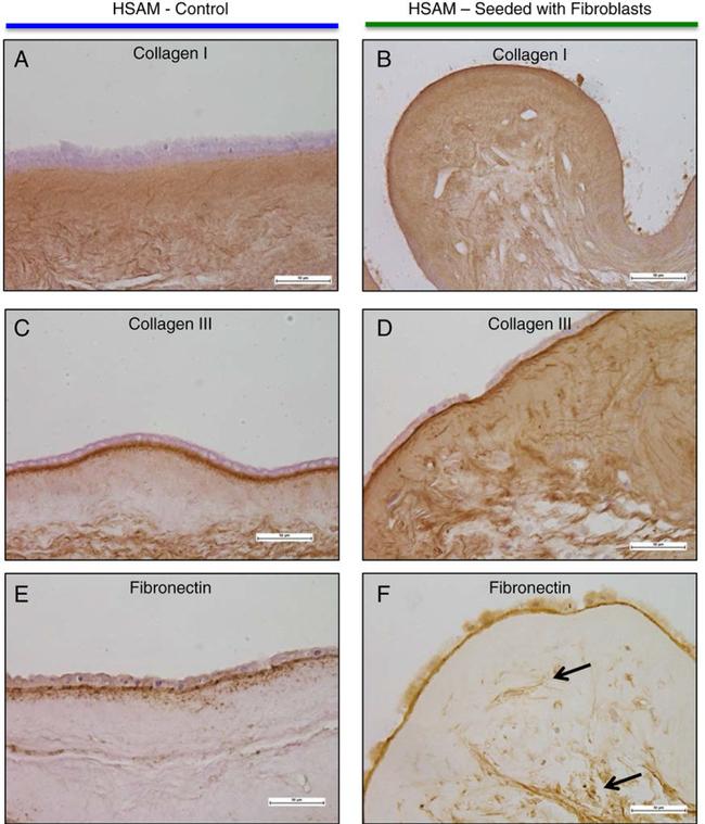 Fibronectin Antibody in Immunohistochemistry (IHC)