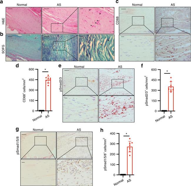 CD68 Antibody in Immunohistochemistry (IHC)