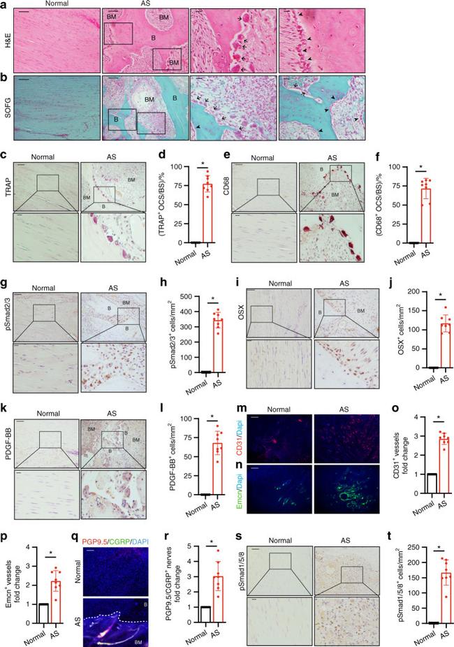 CD68 Antibody in Immunohistochemistry (IHC)