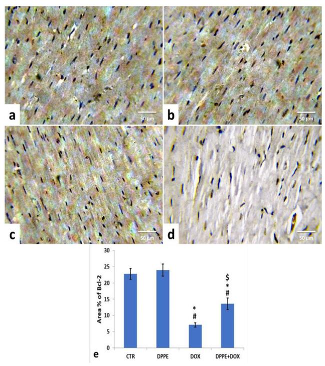 Bcl-2 Antibody in Immunohistochemistry (IHC)