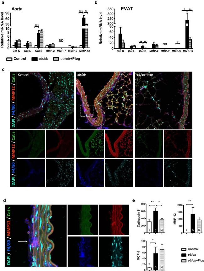 MMP12 Antibody in Immunohistochemistry (IHC)