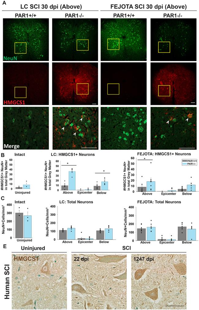 HMGCS1 Antibody in Immunohistochemistry (IHC)