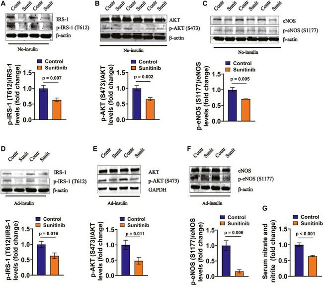 Phospho-IRS1 (Tyr612) Antibody in Western Blot (WB)