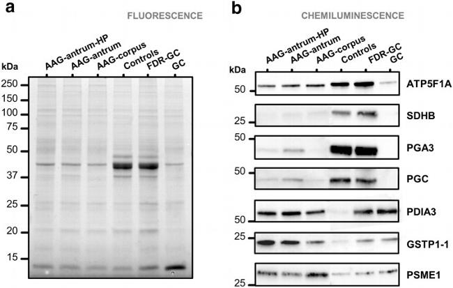 PGA3 Antibody in Western Blot (WB)