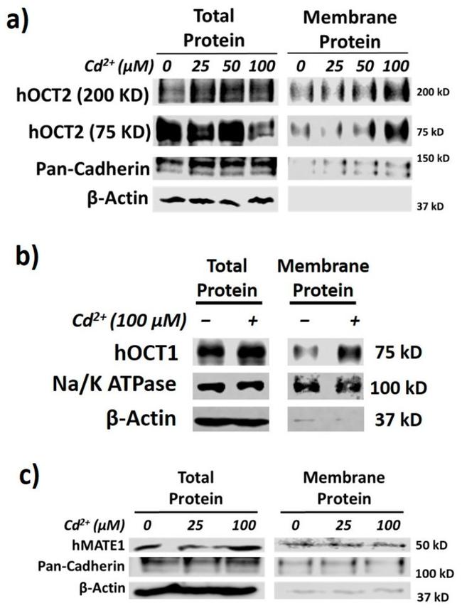 SLC22A2 Antibody in Western Blot (WB)