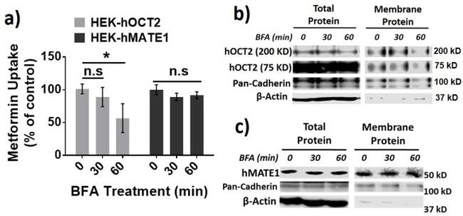 SLC22A2 Antibody in Western Blot (WB)