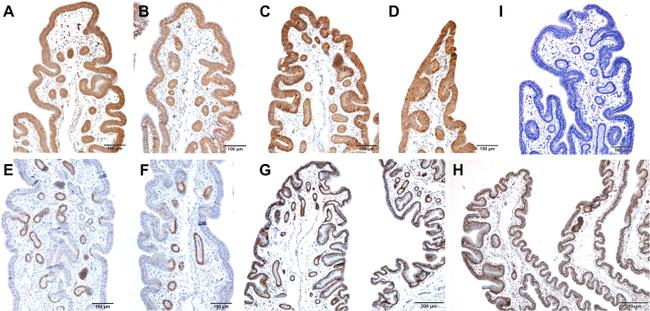 GNAQ Antibody in Immunohistochemistry (IHC)