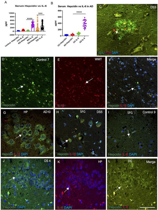 IL-6 Antibody in Immunohistochemistry (IHC)