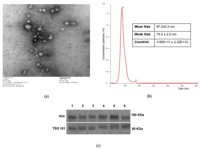 TSG101 Antibody in Western Blot (WB)