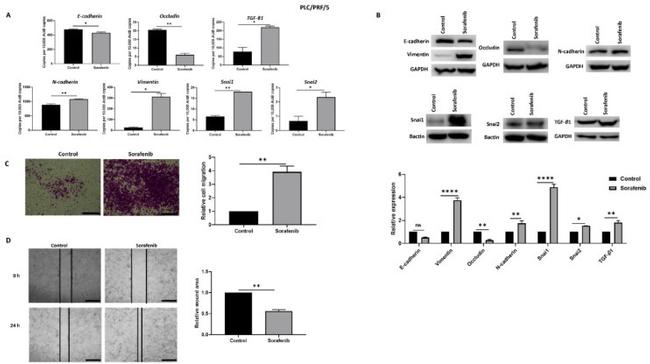 TGF beta-1 Antibody in Western Blot (WB)