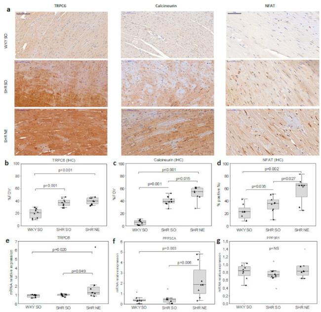 NFATC3 Antibody in Immunohistochemistry (IHC)