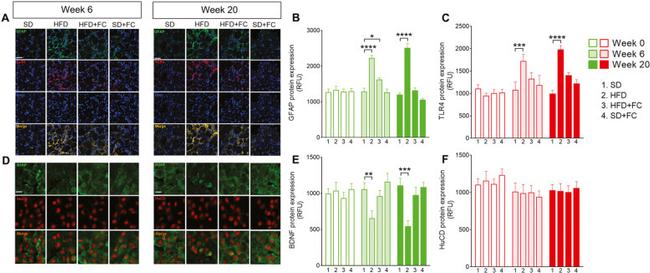 TLR4 Antibody in Immunohistochemistry (IHC)