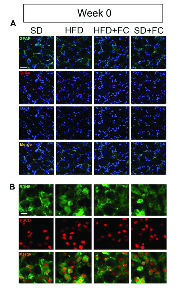 TLR4 Antibody in Immunohistochemistry (IHC)