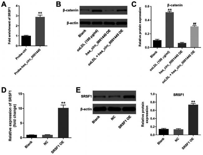 SRSF1 Antibody in Western Blot (WB)