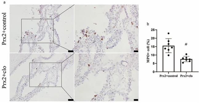 Myeloperoxidase Antibody in Immunohistochemistry (IHC)