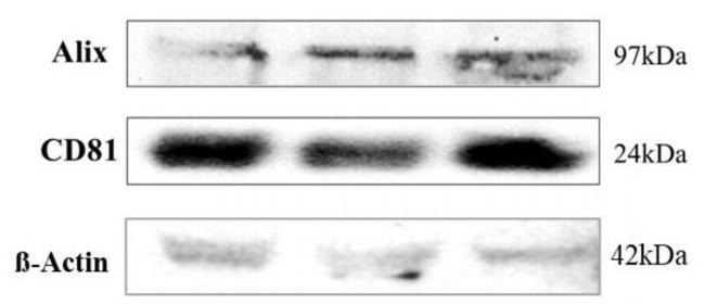 CD81 Antibody in Western Blot (WB)