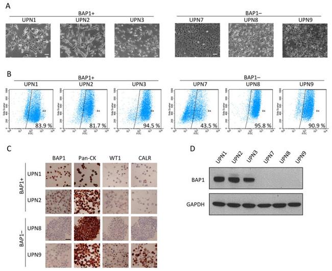 WT1 Antibody in Immunohistochemistry (IHC)