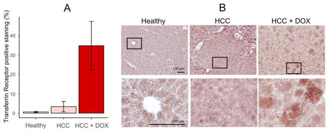 Transferrin Receptor Antibody in Immunohistochemistry (Paraffin) (IHC (P))