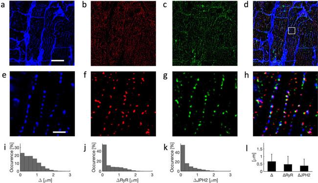 JPH2 Antibody in Immunohistochemistry (Frozen) (IHC (F))