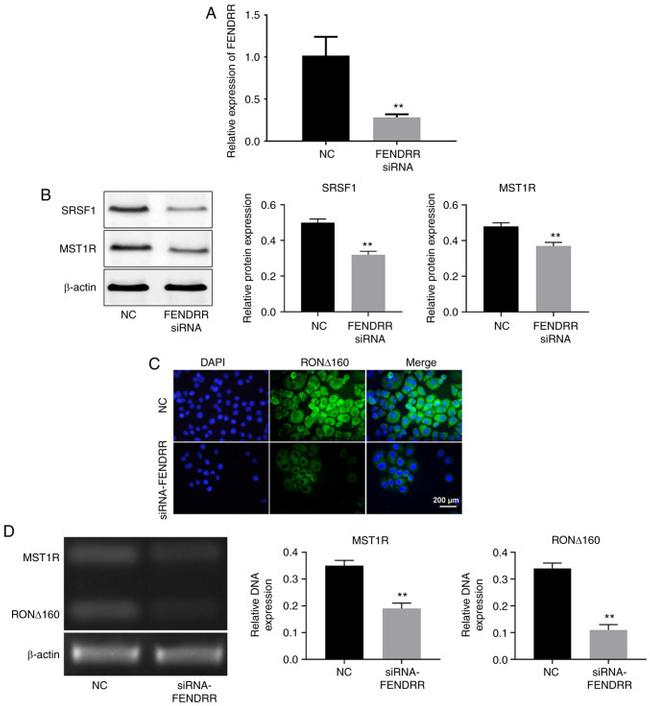 SRSF1 Antibody in Western Blot (WB)