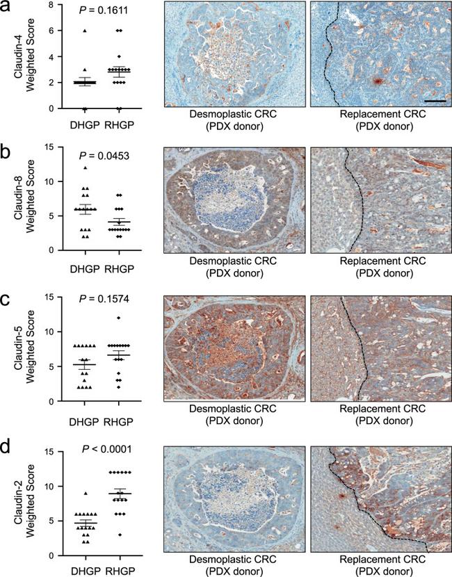 Claudin 4 Antibody in Immunohistochemistry (IHC)