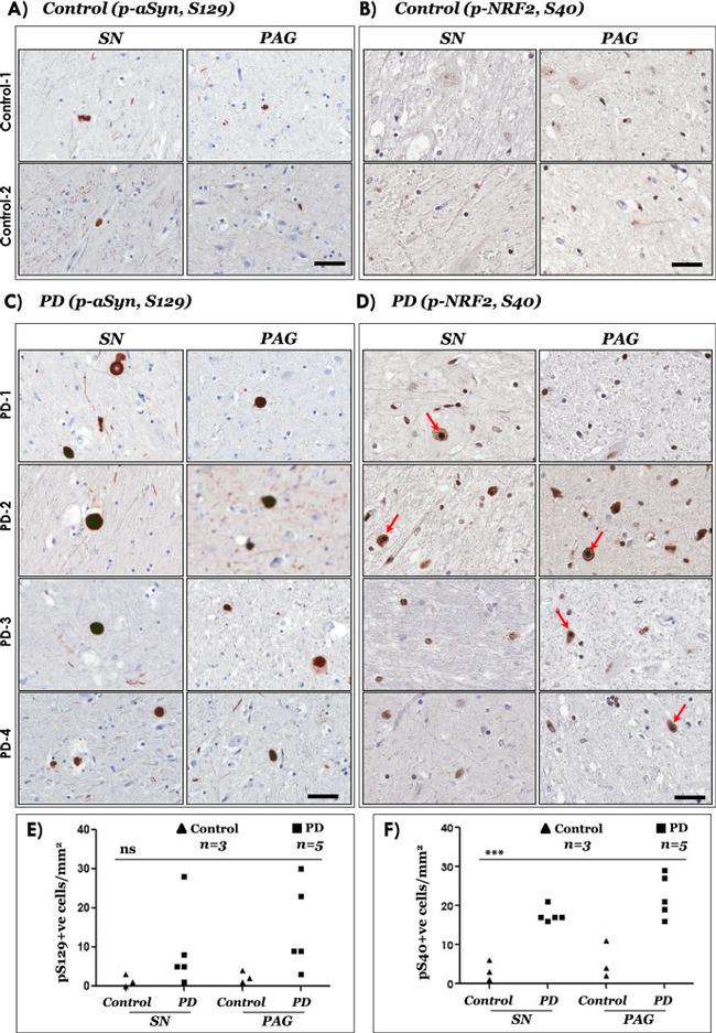 Phospho-Nrf2 (Ser40) Antibody in Immunohistochemistry (IHC)