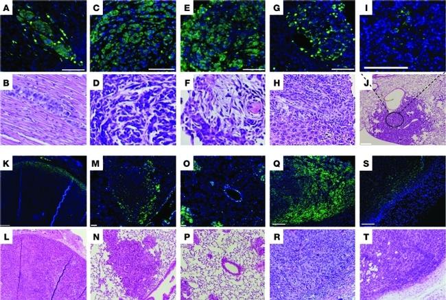 CD133 (Prominin-1) Antibody in Immunohistochemistry (IHC)