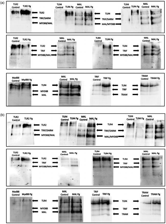 TIRAP Antibody in Western Blot, Immunoprecipitation (WB, IP)