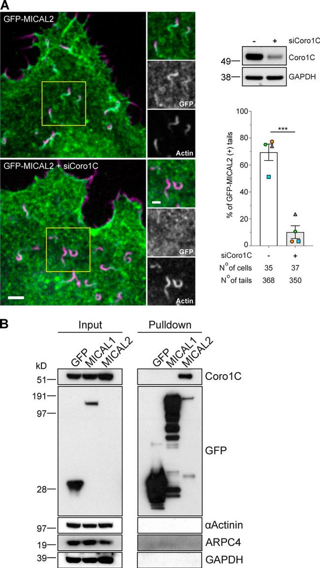 Coronin 3 Antibody in Western Blot (WB)