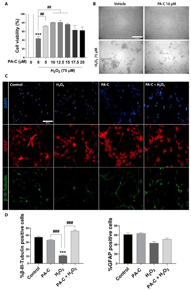 GFAP Antibody in Immunocytochemistry (ICC/IF)