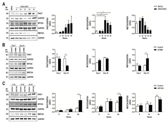 MEF2A Antibody in Western Blot (WB)