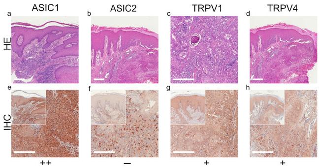 ASIC2 Antibody in Immunohistochemistry (IHC)