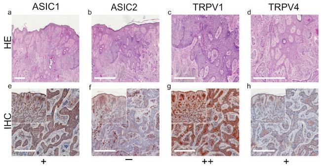 TRPV1 Antibody in Immunohistochemistry (IHC)