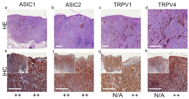 TRPV1 Antibody in Immunohistochemistry (IHC)