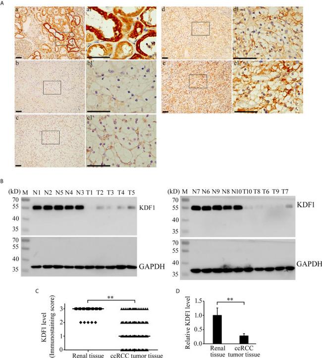 KDF1 Antibody in Western Blot, Immunohistochemistry (Paraffin) (WB, IHC (P))