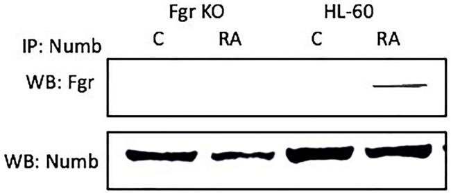 NUMB Antibody in Immunoprecipitation (IP)