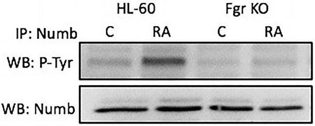 NUMB Antibody in Immunoprecipitation (IP)