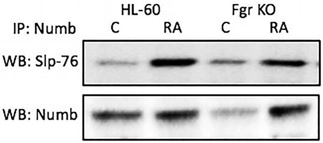 NUMB Antibody in Western Blot, Immunoprecipitation (WB, IP)